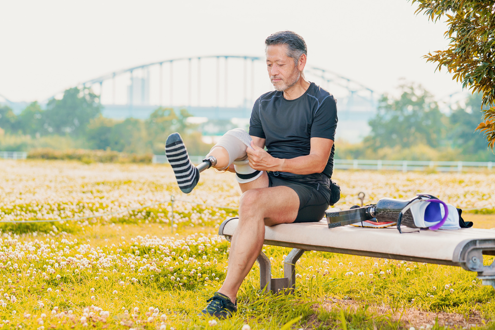 A man sits in a park, fits a prosthesis to his leg.